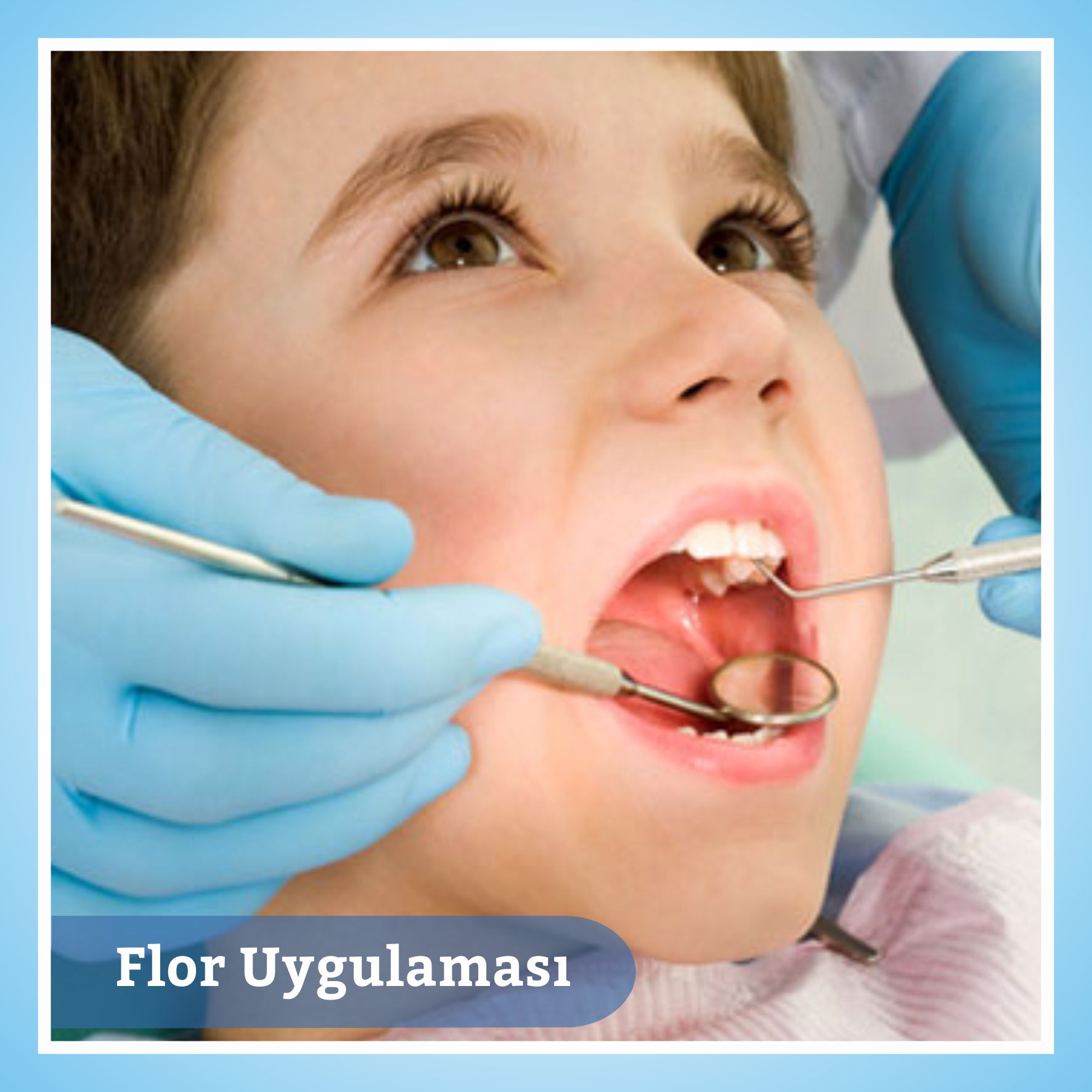 Çocukları 6 ayda bir diş hekimine götürün Çocukları 6 ayda bir diş hekimine götürün