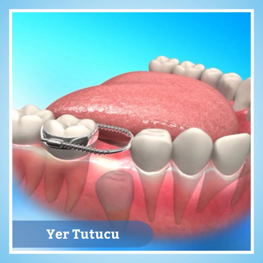 Çocukları 6 ayda bir diş hekimine götürün Çocukları 6 ayda bir diş hekimine götürün