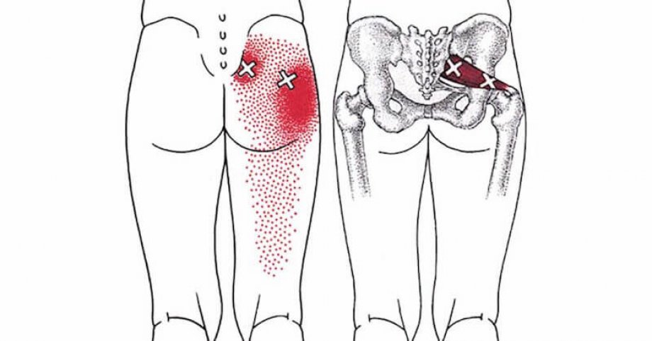 Priformis Germe Egzersizleri