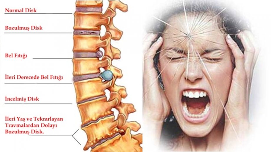 Bel Ağrısı Yapan Hareketler